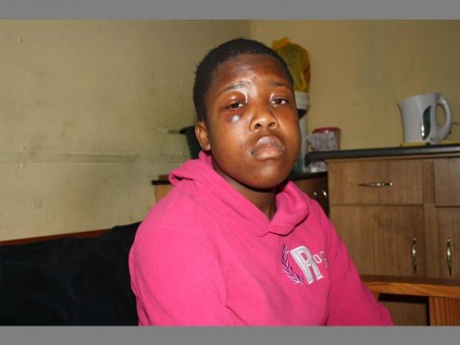 VICTIM of bullying Refilwe Ndlovu (14), a Grade 9 pupil at Alex High School, who was allegedly punched by her male classmate.