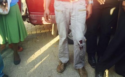 @ewnupdates tweeted this photo and said: EFF member shot during xenophobia march.